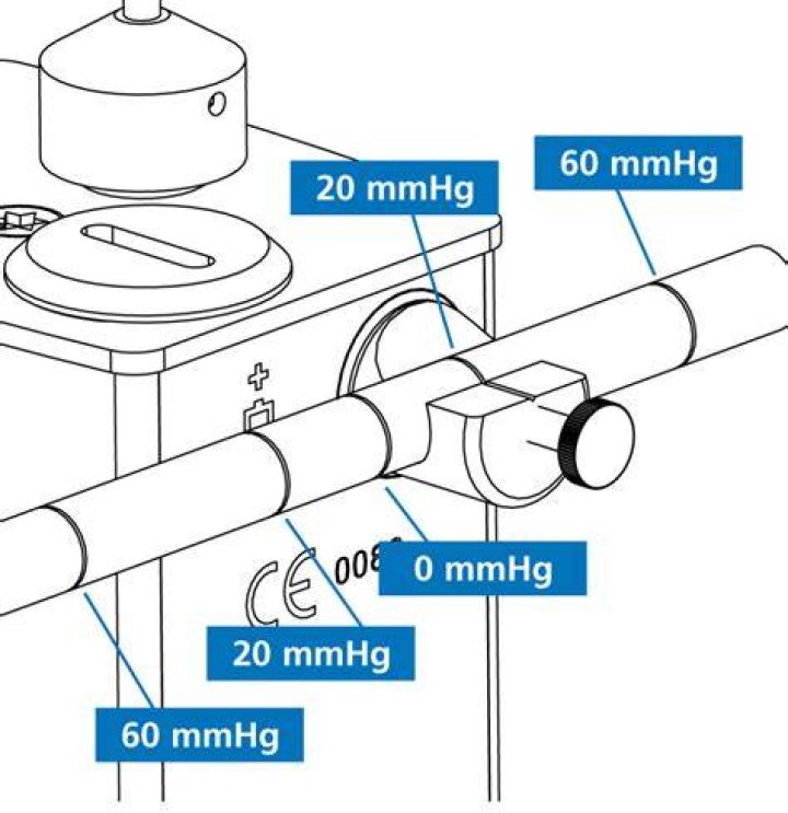 How do you calibrate a Goldmann tonometer?